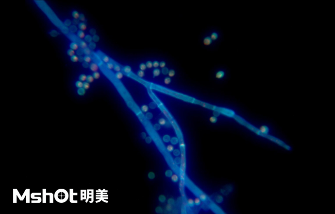 熒光生物顯微鏡下的黃曲霉？